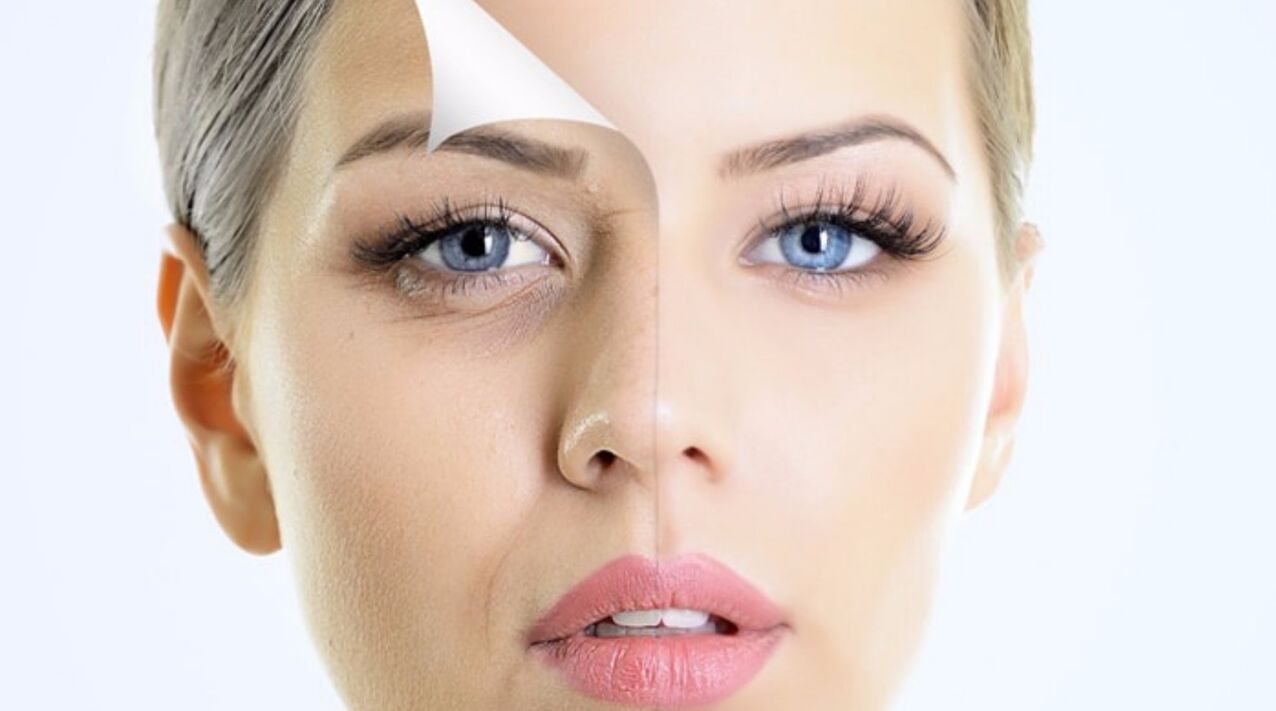 تجديد البشرة مع كريم Inno Gialuron